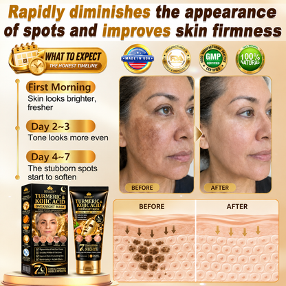 𝑶𝒇𝒇𝒊𝒄𝒊𝒂𝒍 𝑺𝒕𝒐𝒓𝒆 | 𝐍𝐞𝐰!👑 𝐂𝐥𝐞𝐚𝐧𝐬𝐢𝐚® 𝐓𝐮𝐫𝐦𝐞𝐫𝐢𝐜 × 𝐊𝐨𝐣𝐢𝐜 𝐀𝐜𝐢𝐝 𝐎𝐯𝐞𝐫𝐧𝐢𝐠𝐡𝐭 𝐏𝐞𝐞𝐥-𝐎𝐟𝐟 𝐌𝐚𝐬𝐤 — 𝐅𝐚𝐝𝐞 𝐒𝐭𝐮𝐛𝐛𝐨𝐫𝐧 𝐃𝐚𝐫𝐤 𝐒𝐩𝐨𝐭𝐬 & 𝐒𝐦𝐨𝐨𝐭𝐡 𝐕𝐢𝐬𝐢𝐛𝐥𝐞 𝐖𝐫𝐢𝐧𝐤𝐥𝐞𝐬 𝐖𝐡𝐢𝐥𝐞 𝐘𝐨𝐮 𝐒𝐥𝐞𝐞𝐩 🌙✨ 𝐓𝐮𝐫𝐦𝐞𝐫𝐢𝐜 × 𝐊𝐨𝐣𝐢𝐜 𝐀𝐜𝐢𝐝 × 𝐏𝐞𝐩𝐭𝐢𝐝𝐞𝐬 ✅ 𝐎𝐧𝐞 𝐒𝐭𝐞𝐩 𝐚 𝐍𝐢𝐠𝐡𝐭 · 𝐕𝐢𝐬𝐢𝐛𝐥𝐞 𝐂𝐡𝐚𝐧𝐠𝐞𝐬 𝐢𝐧 𝟕 𝐍𝐢𝐠𝐡𝐭𝐬 💯